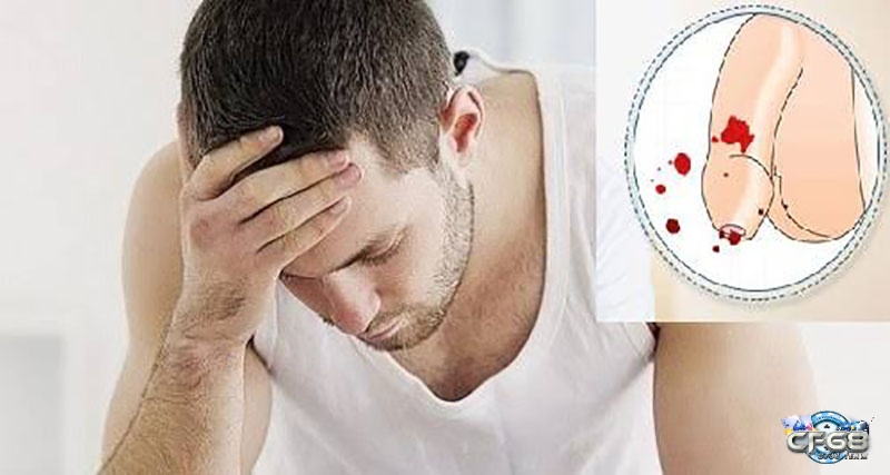 Giấc mơ thấy của quý bị chảy máu nhắc nhở bạn cần cẩn thận hơn với các vấn đề xung quanh mình